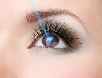 La cirugía de LASIK para corregir el grado puede ser un tratamiento efectivo para el astigmatismo.