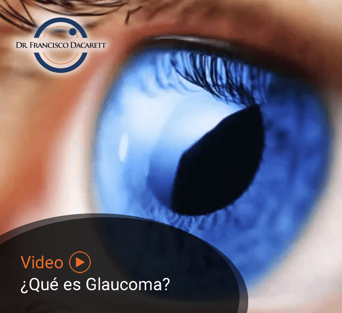 Conoce más sobre ¿Qué es el Glaucoma? por el oftalmólogo y retinólogo Dr. Francisco Dacarett