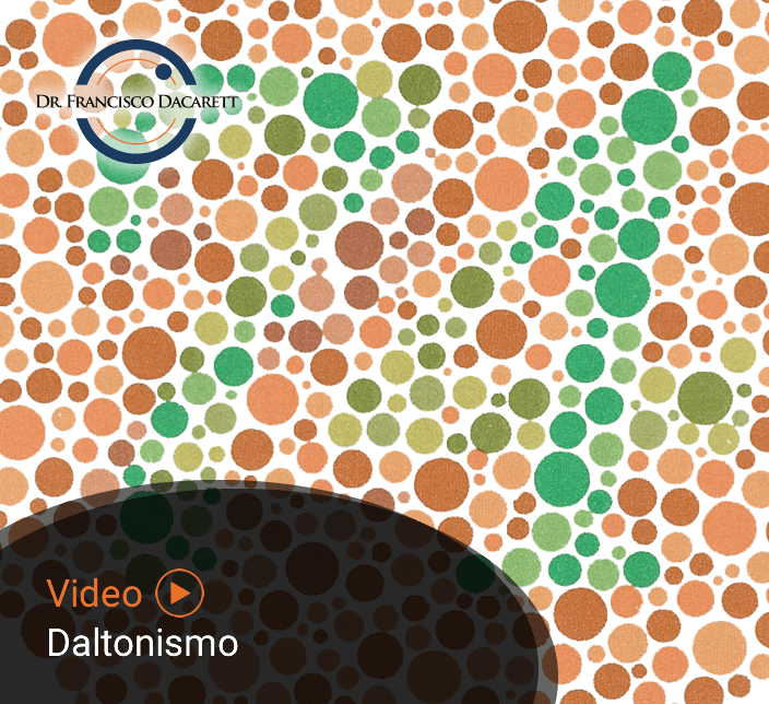 Conoce más sobre el Daltonismo por el oftalmólogo y retinólogo Dr. Francisco Dacarett