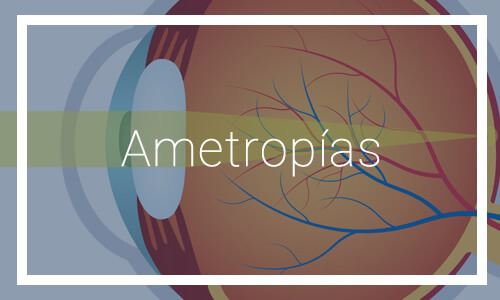 Ametropías - Dr. Francisco Dacarett
